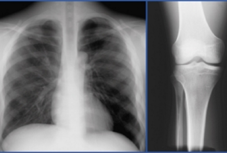 Film Based Imaging Solutions South Florida XRay Imaging, LLC