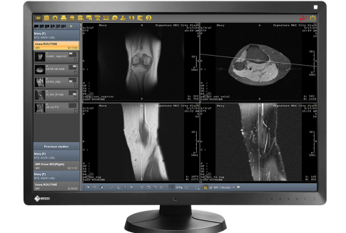 EvoView-PACS-on-PC1